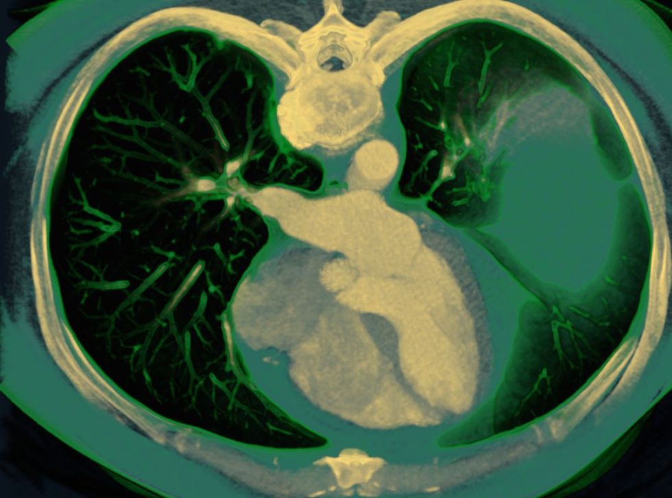 3D Organon XR – Immersives Anatomietraining (VR/AR/MR) / StellDirVor